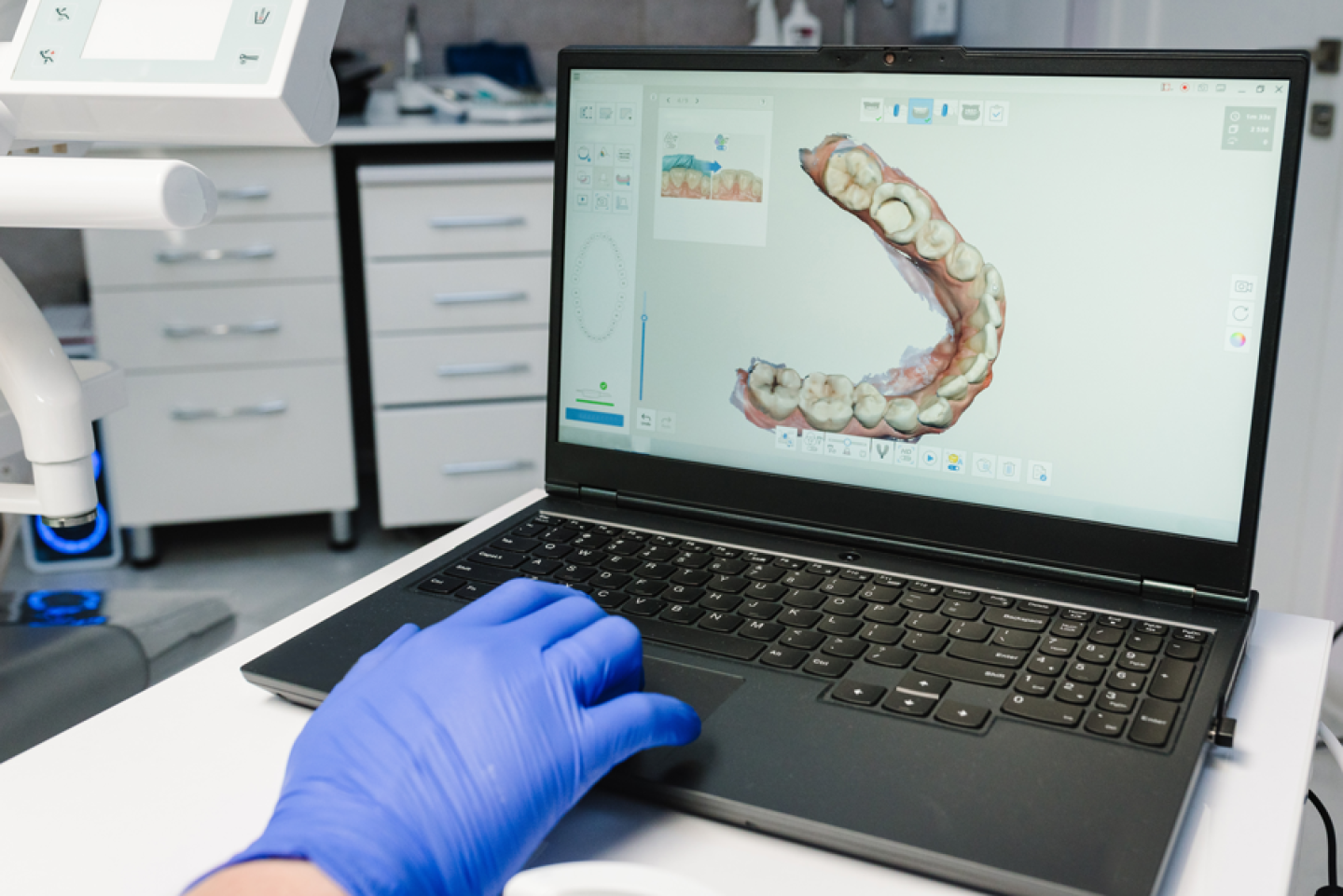Teeth Scanner